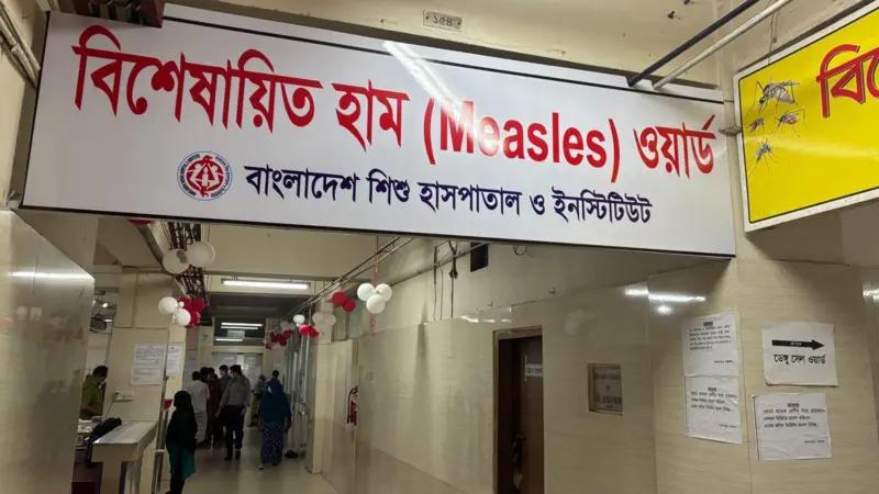 হাম ও উপসর্গ নিয়ে আরও পাঁচ জনের মৃত্যু, নতুন আক্রান্ত ১১১৫