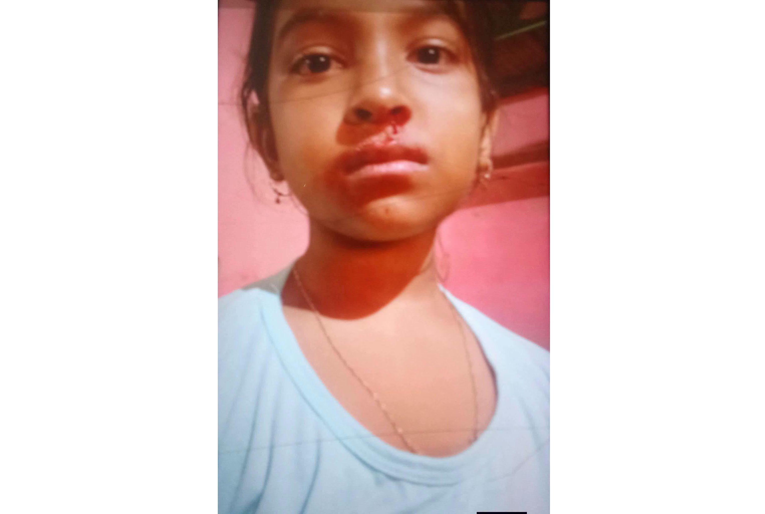 শিক্ষকের মারধরে নাক ফাঁটলো শিক্ষার্থীর! তদন্ত শুরু